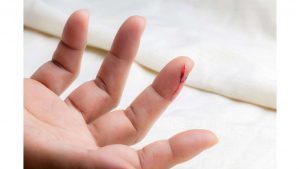 finger cut treatment in marathi
