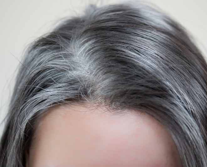Home Remedies For White Hairs
