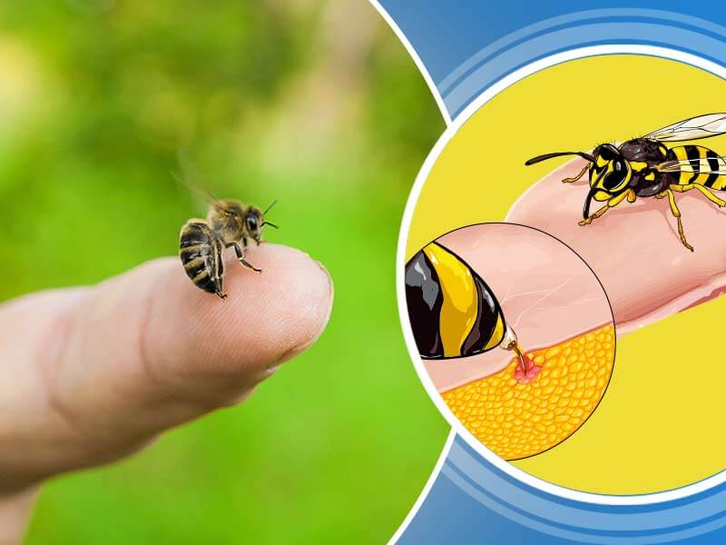Home Remedies If bitten by Honeybees