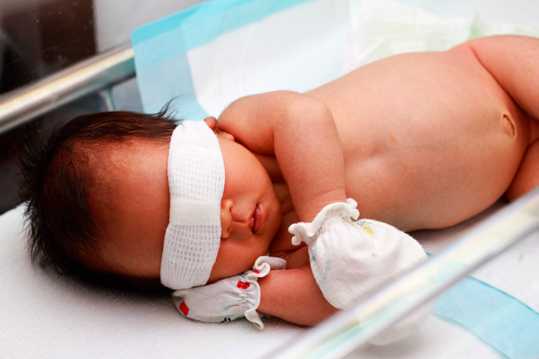 causes of jaundice to newborn baby in marathi