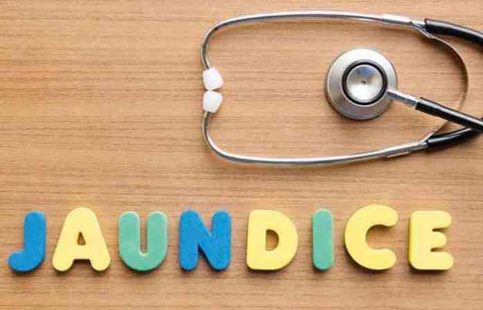 Home Remedies For Jaundice In Marathi